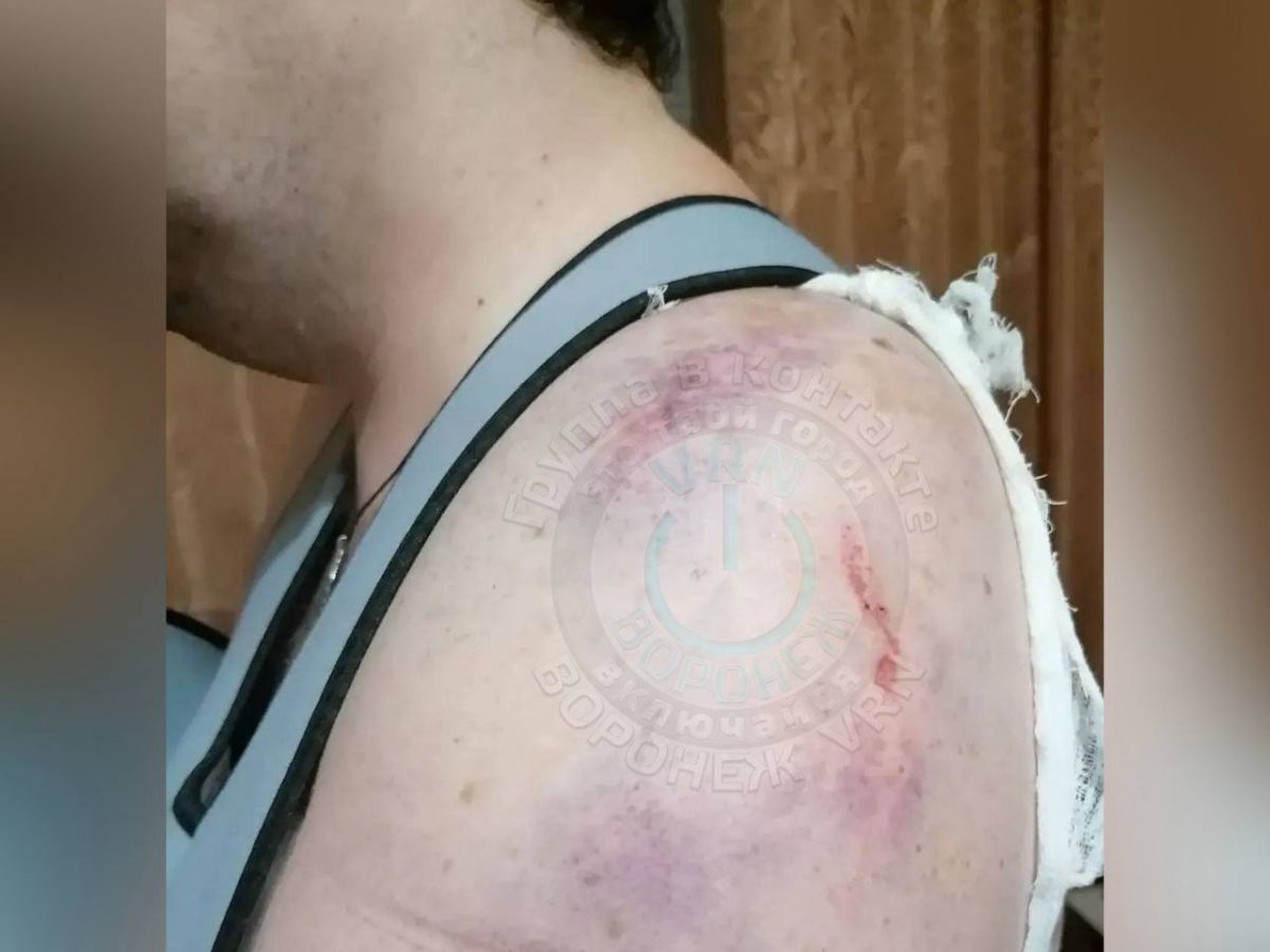 Синяки и ссадины. Воронежец пострадал при резком торможении электробуса