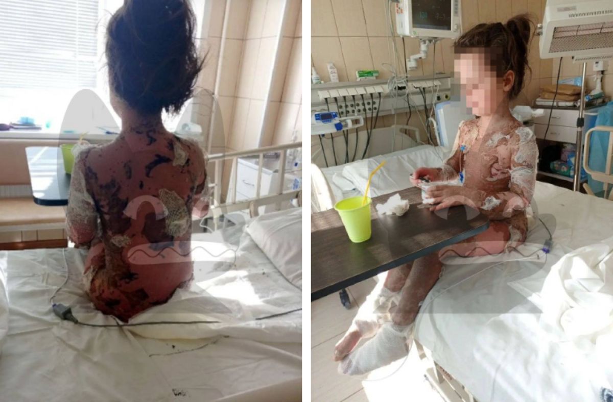 У семилетней девочки из Новой Усмани отслоилась кожа после приёма лекарства: глава СК затребовал доклад